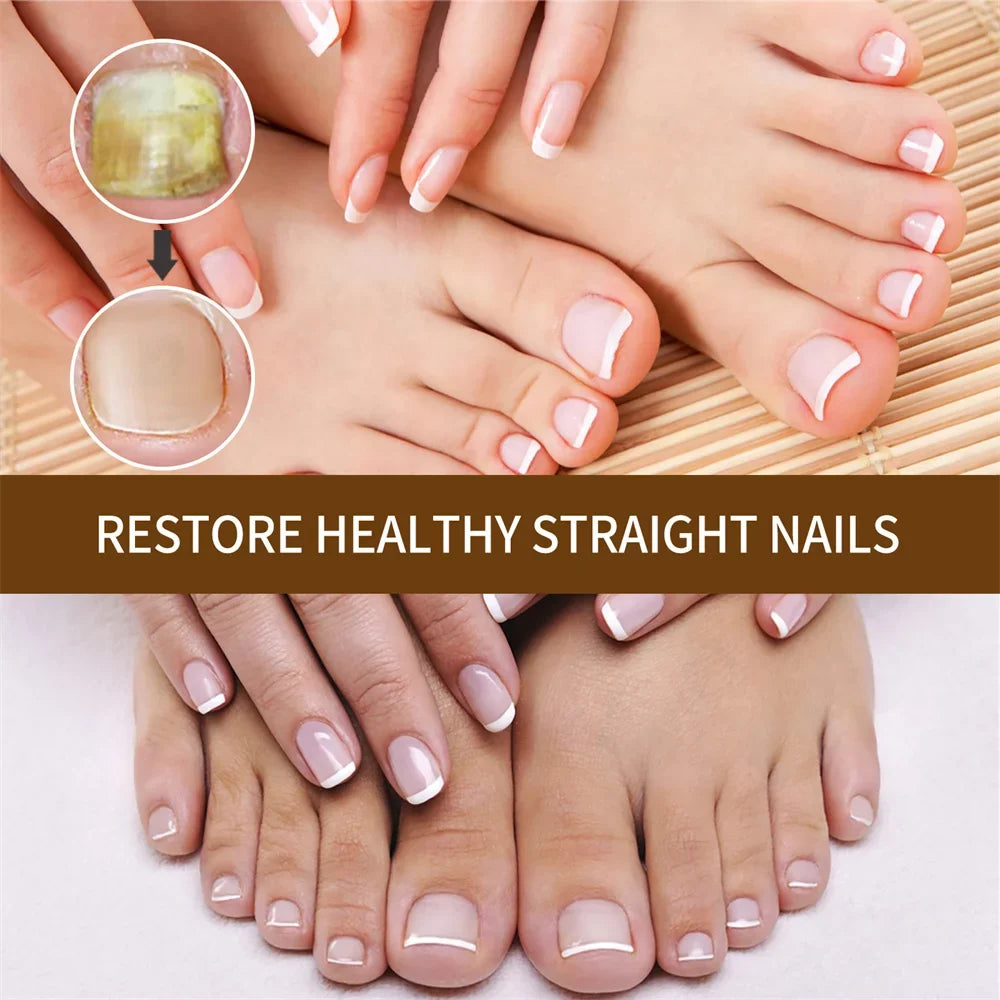 DeepHealing Serum 30ml Growth Organic 2pcs Nail