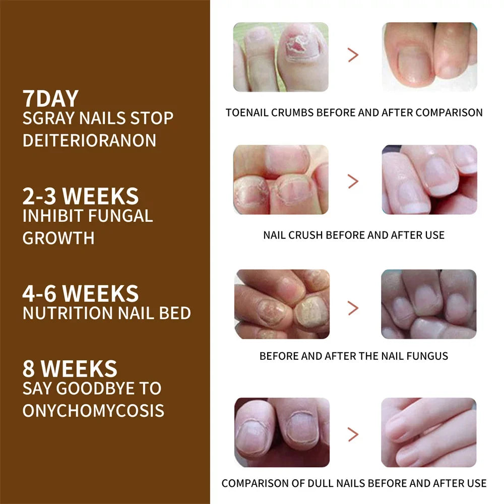 DeepHealing Serum 30ml Growth Organic 2pcs Nail